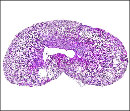 Nierenschnitt einer an Zystennieren erkrankten Maus